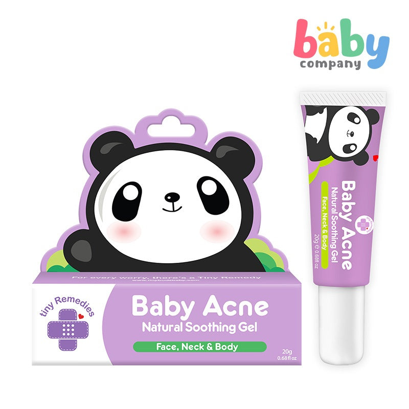 Tiny Buds Baby Acne Soothing Gel 20g