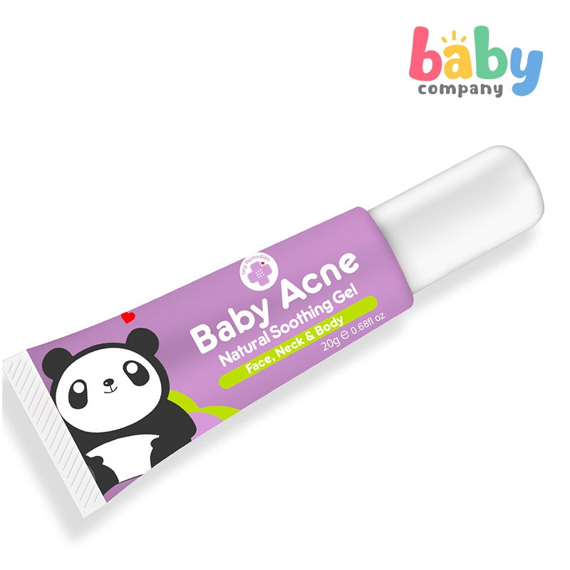 Tiny Buds Baby Acne Soothing Gel 20g